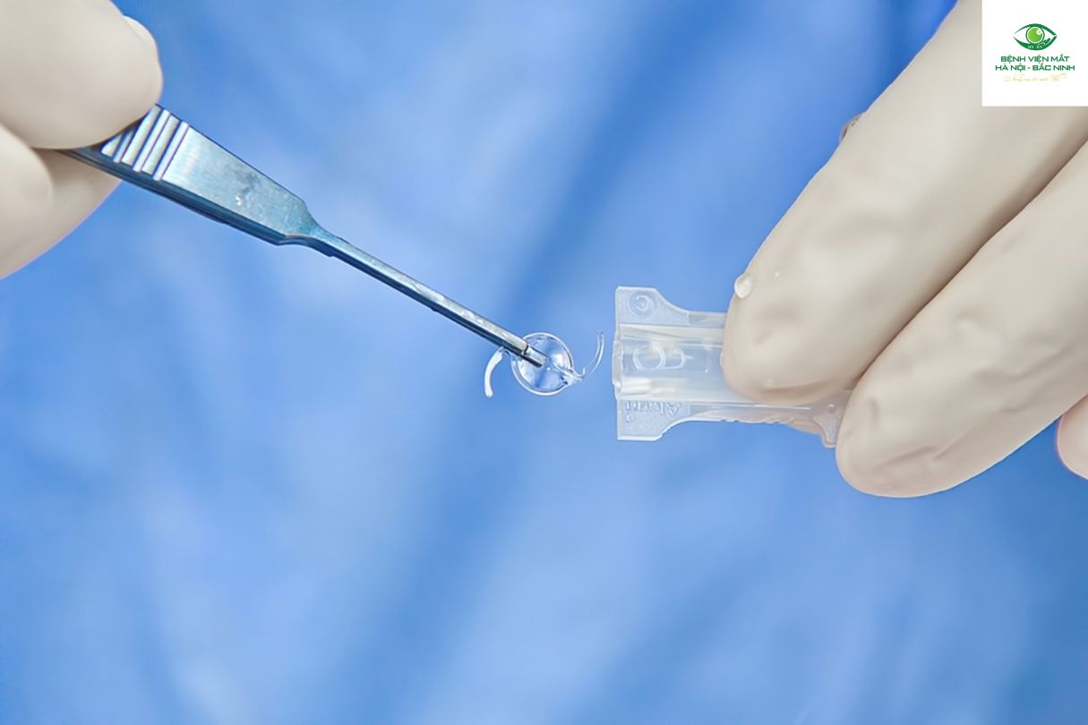 Thuỷ tinh thể đa tiêu cự cao cấp là gì?