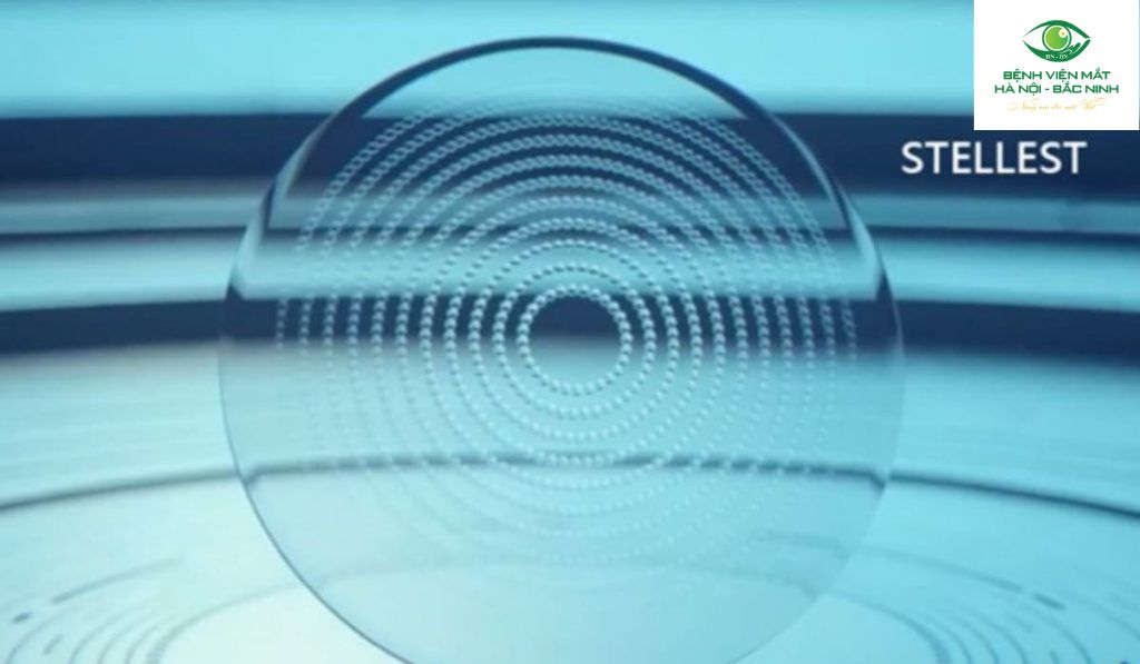 Hiệu quả lâm sàng của tròng kính Essilor Stellest