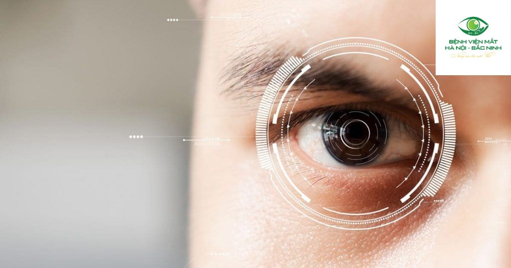 Độ ổn định lâu dài của Thuỷ tinh thể đơn tiêu cự