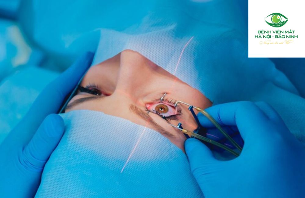 Từ thực tế lâm sàng, phẫu thuật phaco mang lại lợi ích