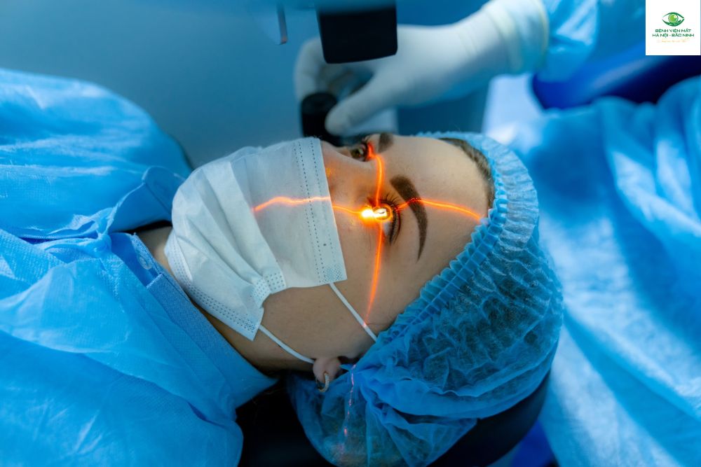 Độ ổn định thị lực lâu dài sau phẫu thuật